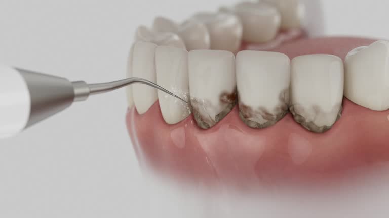 Reliable Dental contractor in Troy, OH by Dentist Open Now
